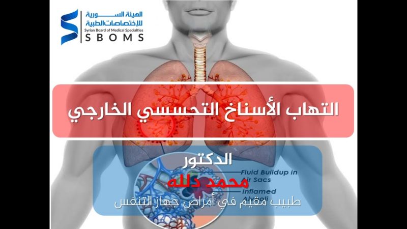 1الهيئة السورية للاختصاصات الطبية التهاب الأسناخ التحسسي الخارجي External Allergic Alveolitis