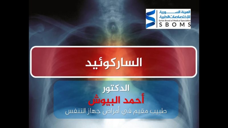 1الهيئة السورية للاختصاصات الطبية الساركوئيد