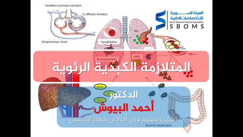 1الهيئة السورية للاختصاصات الطبية المتلازمية الكبدية الرئوية