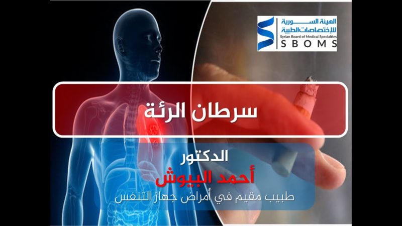 1الهيئة السورية للاختصاصات الطبية سرطان الرئة