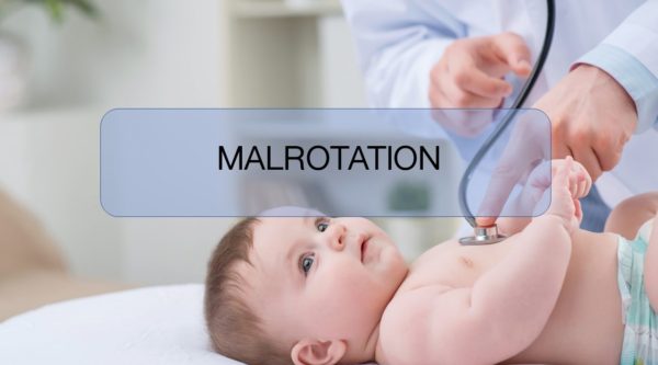 MALROTATION عند الأطفال الهيئة السورية للاختصاصات الطبية المجلس العلمي لطب الأطفال