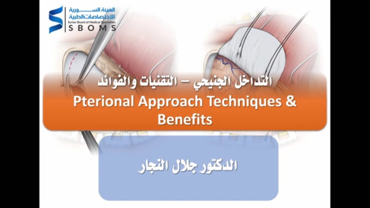 التداخل الجنيحي – التقنيات والفوائد - Pterional Approach Techniques & Benefits