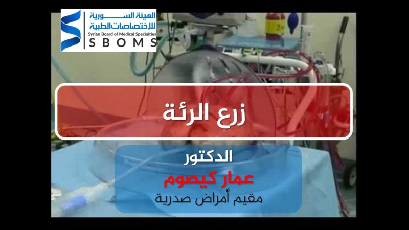 الهيئة السورية للاختصاصات الطبية .زرع الرئة Lung transplantation