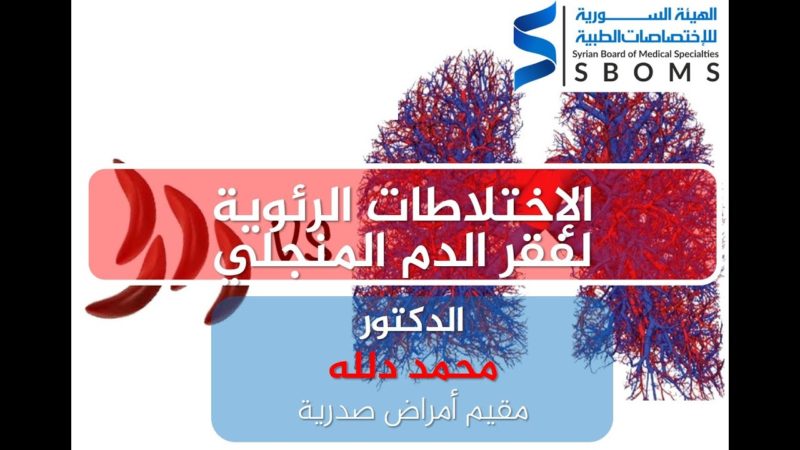 الهيئة السورية للاختصاصات الطبية الإختلاطات الرئوية لفقر الدم المنجلي