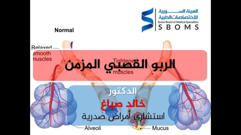 الهيئة السورية للاختصاصات الطبية الربو القصبي المزمن