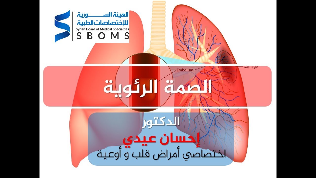 الهيئة السورية للاختصاصات الطبية الصمة الرئوية