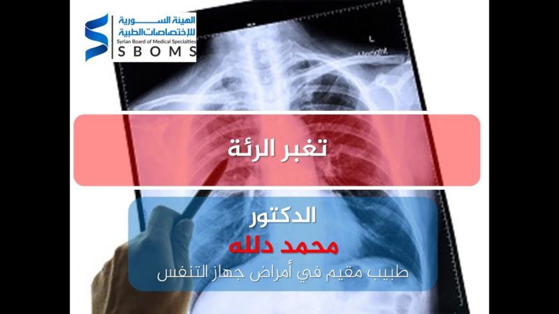 الهيئة السورية للاختصاصات الطبية تغبر الرئة