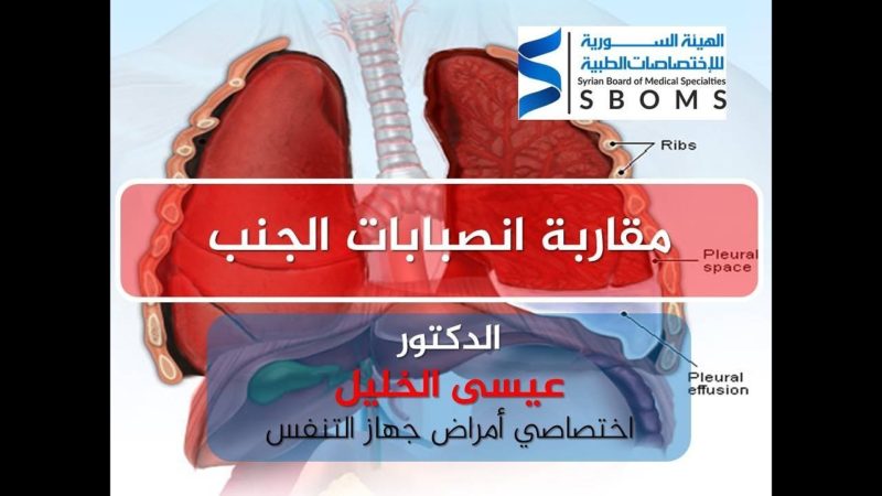 الهيئة السورية للاختصاصات الطبية مقاربة أمراض الجنب - د. عيسى الخليل