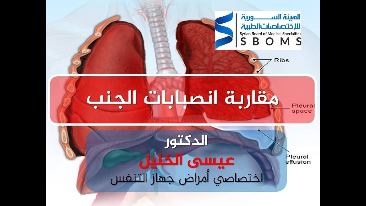 الهيئة السورية للاختصاصات الطبية مقاربة أمراض الجنب - د. عيسى الخليل