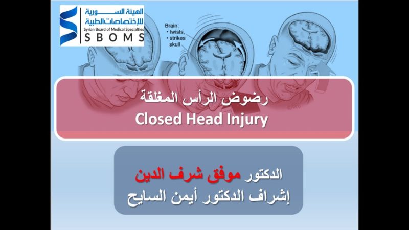 رضوض الرأس المغلقة CLOSED HEAD INJURY الهيئة السورية للاختصاصات الطبية SBOMS