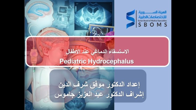 ستسقاء الدماغ في الأطفال Peadiatric Hydrocyphalus الهيئة السورية للاختصاصات الطبية SBOMS
