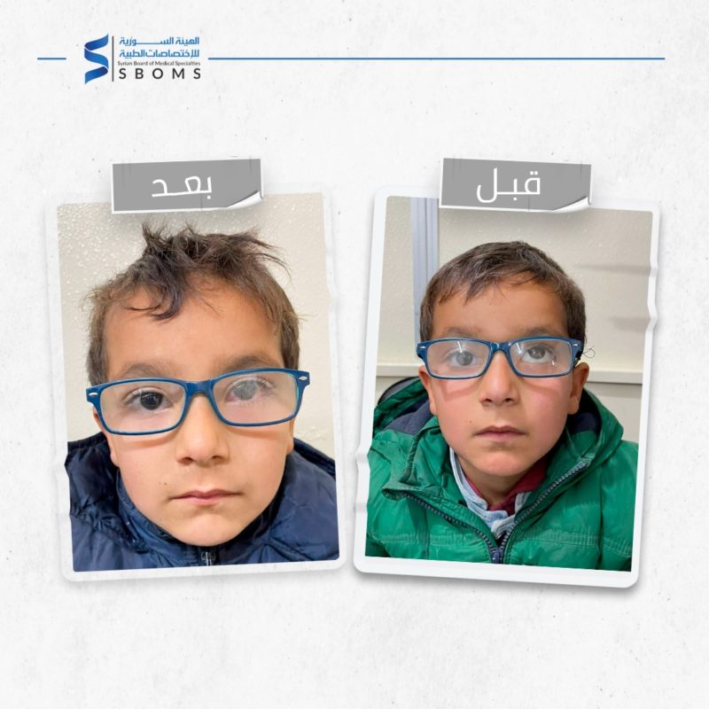 قصة نجاح في مشفى شهيد محمد وسيم معاز أحد مراكز التدريب في الهيئة السورية للاختصاصات الطبية