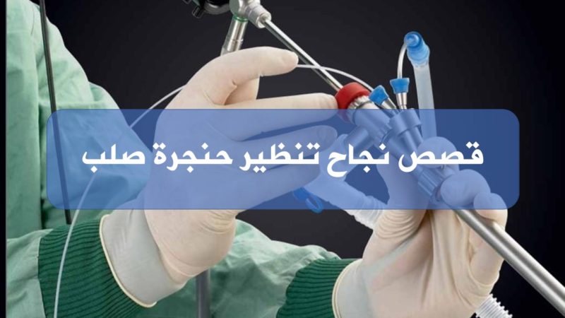 قصص نجاح تنظير حنجرة صلب الهيئة السورية للإختصاصات الطبية